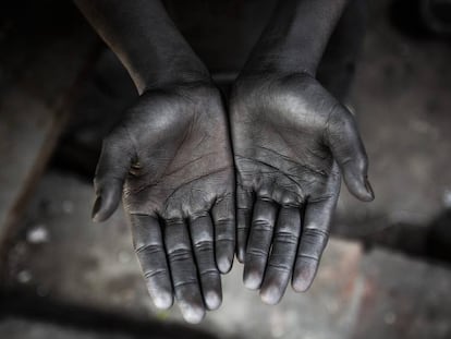 Restos de aluminio en las manos de un niño que trabaja en una fábrica en Dacca (Bangladés).