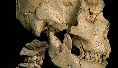 Un emblema de Atapuerca, el cráneo 5 completo con vértebras, bautizado como Miguelón.