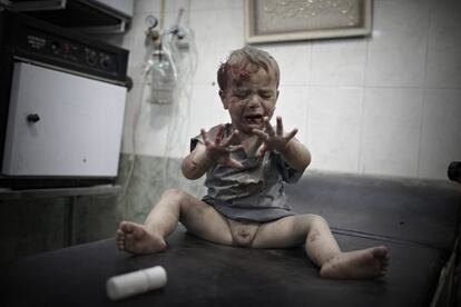 Un niño herido espera que lo atiendan en uno de los pocos hospitales aún en pie en Alepo, Siria. Octubre de 2012.