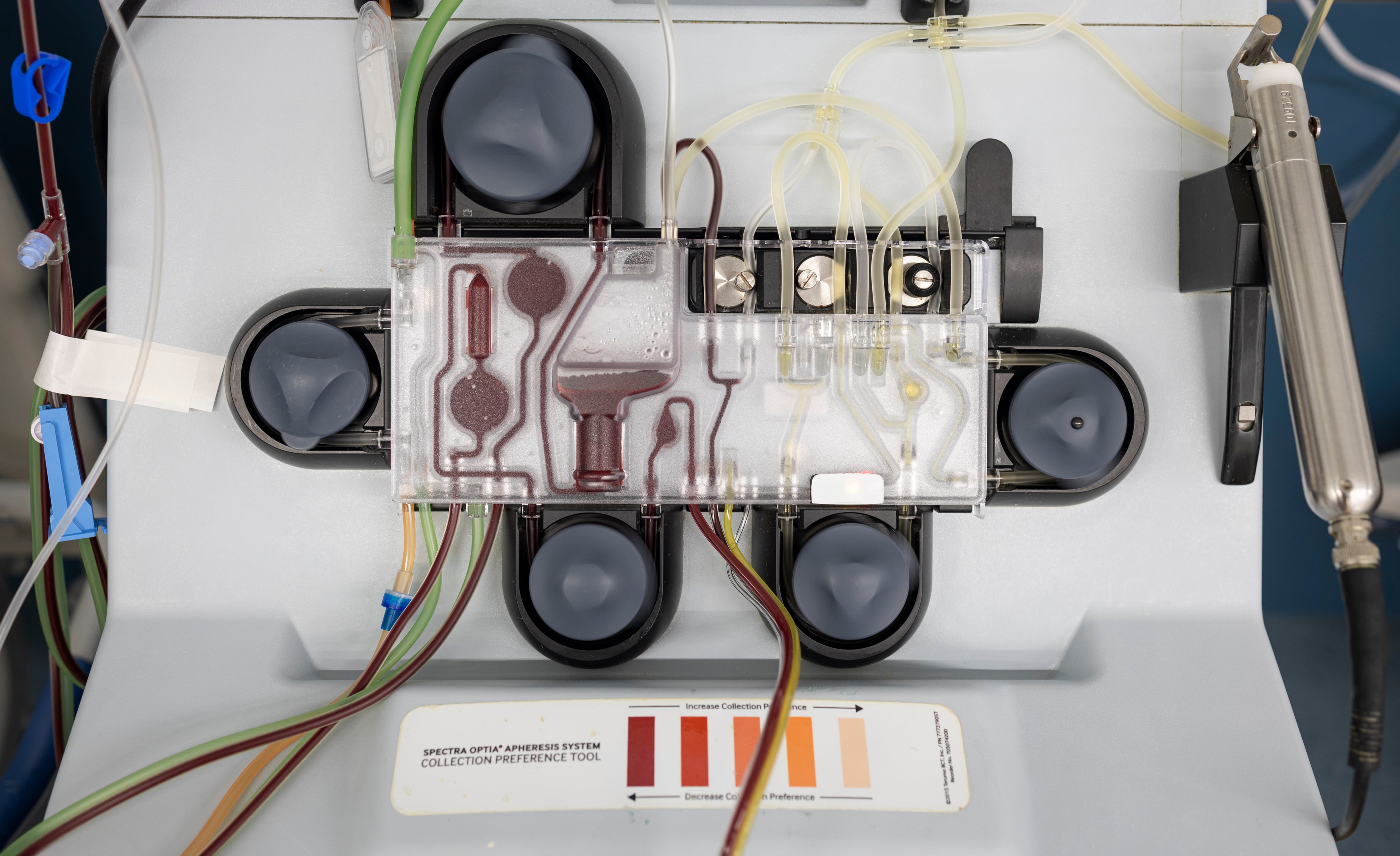 Detalle del separador celular donde se separan los componentes de la sangre para recolectar los linfocitos T necesarios para la terapia CAR-T.
