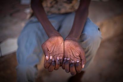 Abduz Aziz Diop muestra sus manos atrofiadas por la enfermedad que sufre, una neuropatía congénita, en su habitación en la casa familiar de Yoff, en Dakar. Tiene una gran memoria y es capaz de recitar versos del Corán sin dificultad, pero no ha podido encontrar un empleo debido a sus problemas de salud.