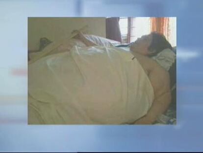 Muere uno de los hombres más obesos del mundo