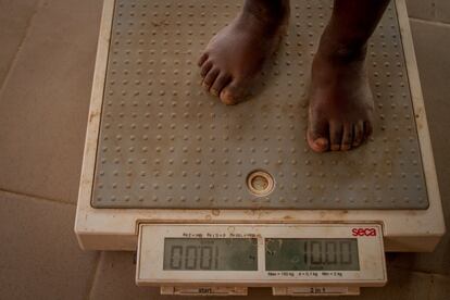 Bakary Coulbaly, de 23 meses, pesa 10 kilos. Fue llevado por primera vez el 29 de diciembre de 2015 con malnutrición severa y 'kwashiorkor', una enfermedad que se da cuando se sufre una carencia de proteínas y otros micronutrientes. Su peso entonces era de 8,3 kilos.