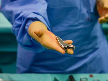 Un cirujano muestra una parte de una prótesis de cadera antes de su implantación en el Hospital Saint George Clinic, en Niza (Francia).