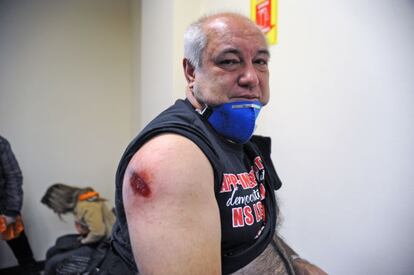 Ferido na manifestação na capital do Paraná.