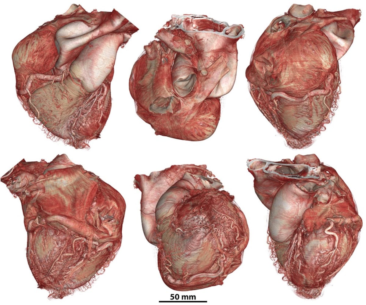 A new interactive atlas reveals the human body in unprecedented detail