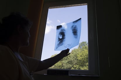 Radiografía. La tasa de enfermedades pulmonares en la ciudad es muy alta.