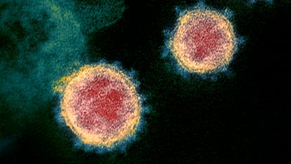 Imagen al microscopio del virus SARS-CoV-2.
