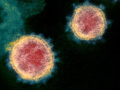 El coronavirus, visto en un microscopio electrónico.