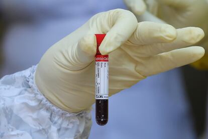 Muestra de sangre tomada de un paciente con coronavirus en Colombo (Sri Lanka), el 4 de mayo.