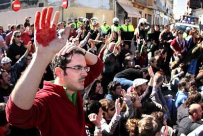 Un joven, con una brecha en la cabeza, tras la carga de la policía.