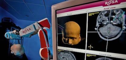 El robot Rosa ayuda a tratar la epilepsia.