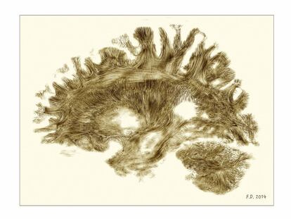 Imagen conseguida mediante una resonancia magnética que muestra un cerebro humano adulto y sano. Este tipo de imágenes sirven para enseñar neuroanatomía y elaborar atlas del cerebro humano.