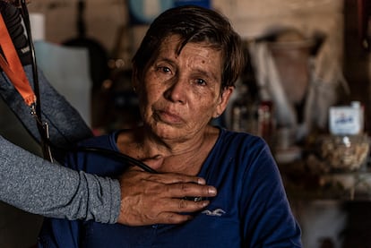 María Zavala recibe atención médica al interior de su casa en Jesús María, luego de sufrir episodios de crisis nerviosas por lo sucedido en el pueblo.