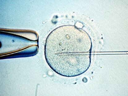 Manipulación de un óvulo en el laboratorio.