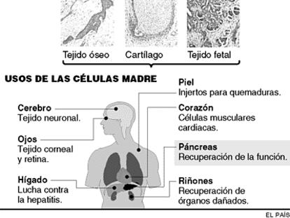 Células madre para curar la diabetes