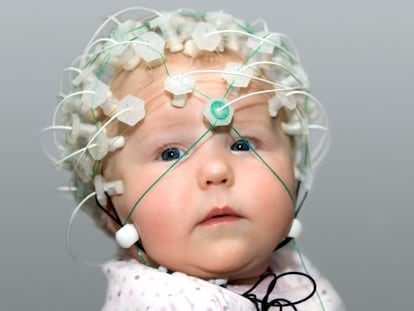 Un beb&eacute; de seis meses con un casco de electrodos para registrar su actividad cerebral.