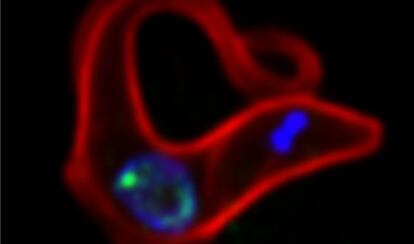 Un tripanosoma, el parásito que causa la enfermedad del sueño.