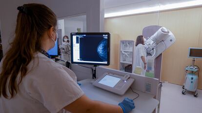 Sección de Radiología de la Mujer del Hospital Vall d'Hebron, de Barcelona, durante una prueba de una paciente.