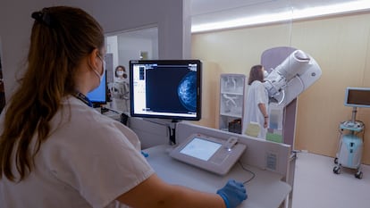 Sección de Radiología de la Mujer del Hospital Vall d'Hebron, de Barcelona, durante una prueba de una paciente.