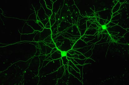 Neuronas en cultivo.