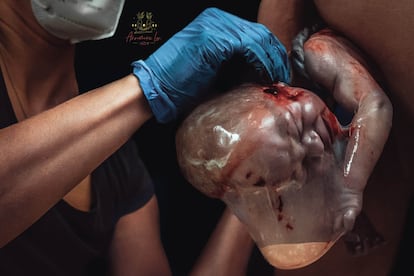 'Crossing the Veil' (Cruzando el velo) es la imagen elegida por el jurado como la mejor foto de esta edición. También ha ganado el premio a la mejor foto artística en detalle del nacimiento. 