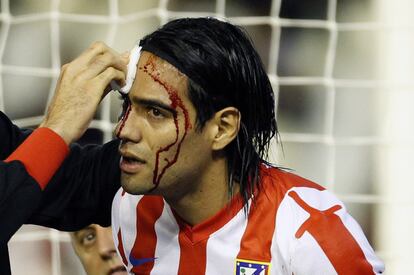 Falcao es atendido por los medicos del Atletico después de chocar con Soldado.