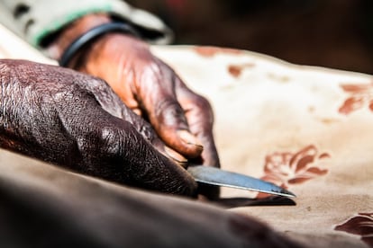 La mayoría de los que realizan las circuncisiones utilizan cuchillos, cuchillas de afeitar y tijeras.