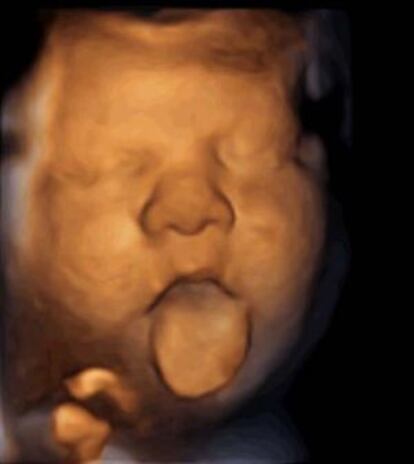 Fotografia del fetus traient la llengua com a resposta a l'estímul musical.