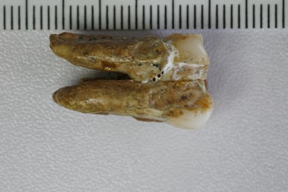 Homo erectus