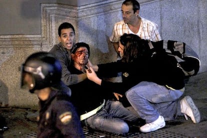 Francisco Javier, después de haber sido herido en la carga policial del martes.