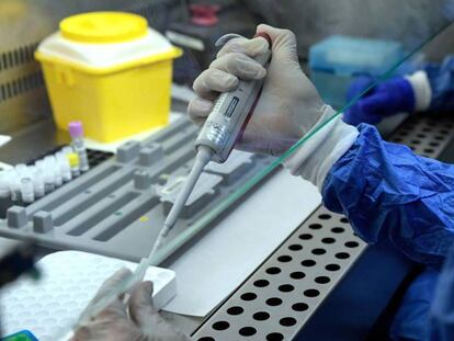 Un médico del hospital Ramón y Cajal de Madrid realiza una prueba PCR.