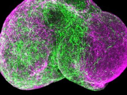 La generación a partir de células madre de las arquitecturas típicas del córtex frontal abre un continente a la neurología