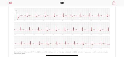 Electrocardiograma en Apple Watch Series 4