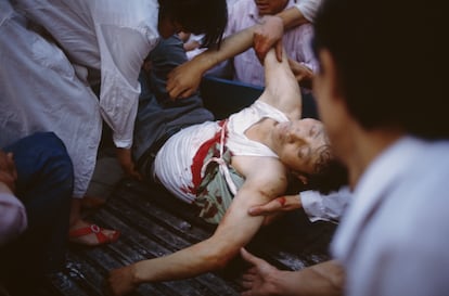 A person injured after protests in the Plaza de Tiananmen de Beijin, in June 1989.
