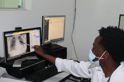 El doctor Dinis Nguenha analizaba los resultados de una radiografía realizada durante la visita a una paciente, en abril en Manhiça.
