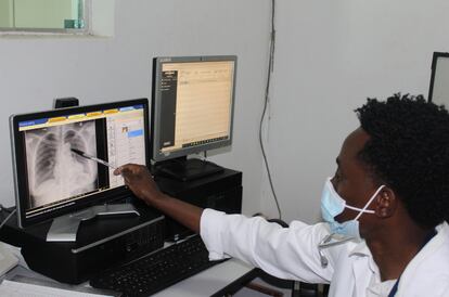 Dr. Dinis Nguenha analyzed the results of an x-ray taken during a visit to a patient in April in Manhiça.