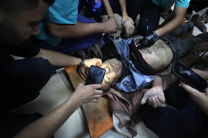 Un palestino herido en un ataque israelí es atendido en el hospital Al Aqsa de Deir el Balah, en Gaza.