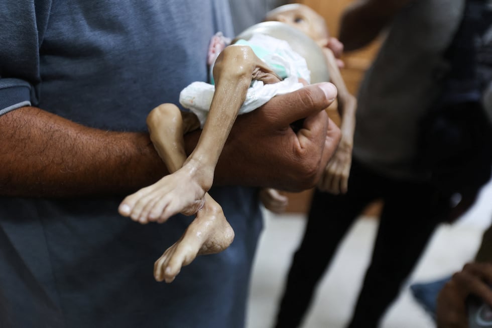 El cadáver de una niña muerta por malnutrición, en el hospital Nasser de Jan Yunis, este sábado.  