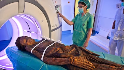 La momia guanche del Arqueológico Nacional, cuando fue sometida a una tomografía axial computarizada en el Hospital Quirón de Madrid.
