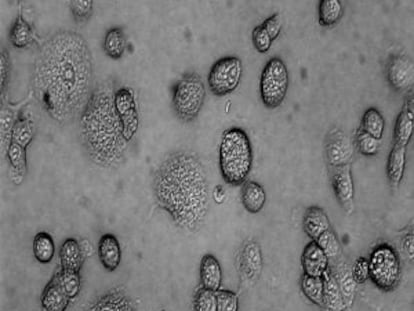 Células infectadas por el tripanosoma que causa la enfermedad de Chagas.