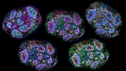 Revolución en neuromedicina al lograr minicerebros humanos que se mantienen vivos durante años