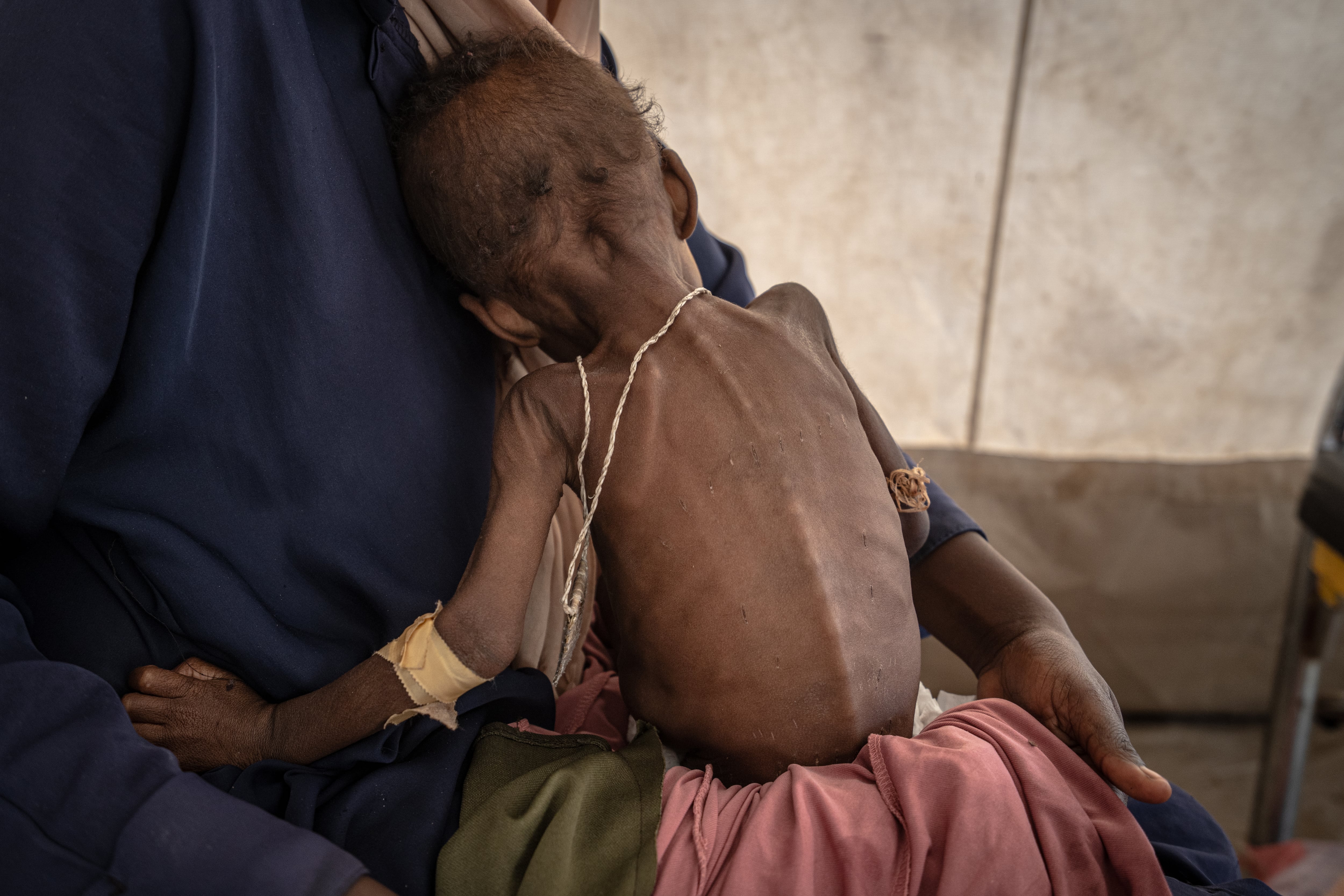 África supera a Asia por primera vez como el continente con más personas que padecen hambre