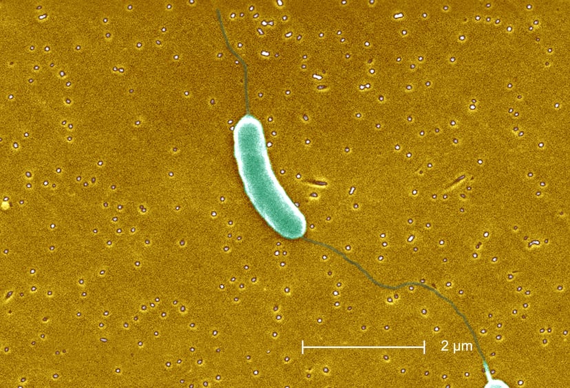 Lo que sabemos de la bacteria carne’ en Florida EL PAÍS US