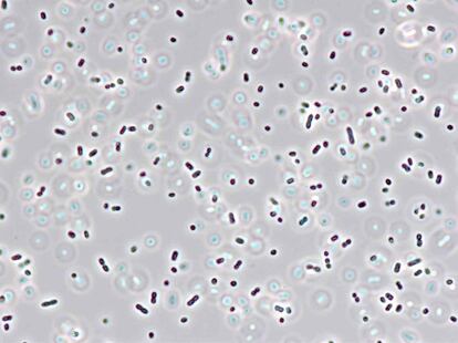 Fotografa microscpica de la bacteria Klebsiella oxytoca.