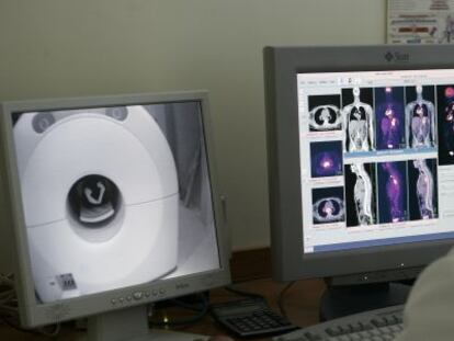 Un profesional realiza una tomografíen el Instituto PET Doctor Carreras