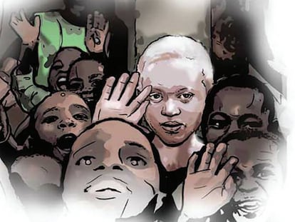 En Malaui, hay entre 7.000 y 10.000 personas con albinismo.