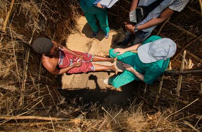 Las pruebas de sensibilidad continuan realizándose también en las plantas de los pies. Si un paciente tiene lepra corre más riesgo de sufrir traumatismos, úlceras, etc. en la planta de los pies, que pueden infectarse debido a la falta de sensibilidad.