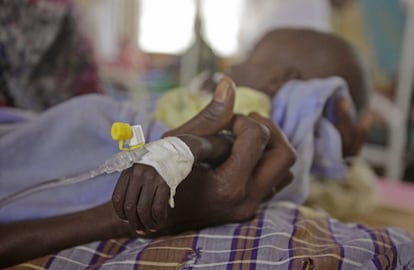 Un niño que sufre desnutrición en un hospital de Kenia.