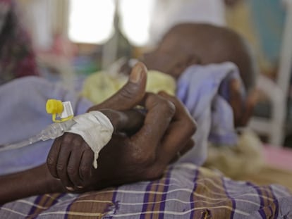 Un niño que sufre desnutrición en un hospital de Kenia.